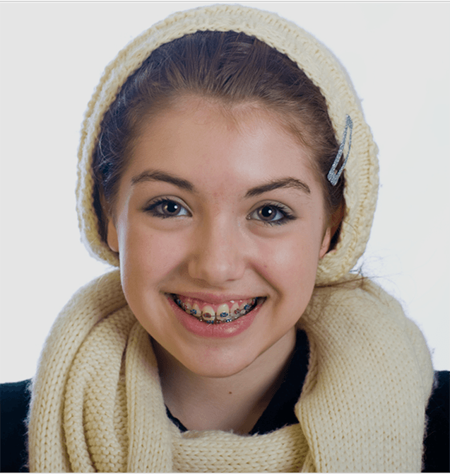 Ceramic/Metal Braces